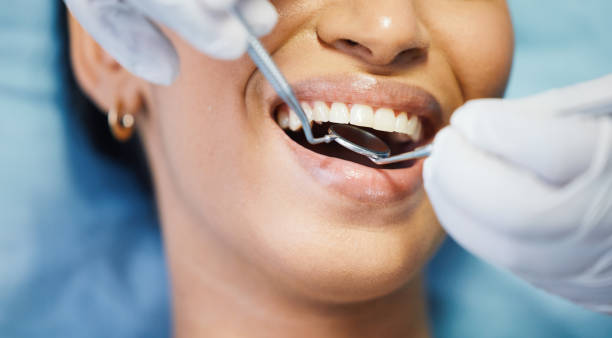 Best Emergency Wisdom Teeth Removal in Wamego, KS
