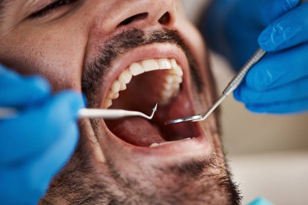 Best Emergency Broken Tooth Repair in Wamego, KS