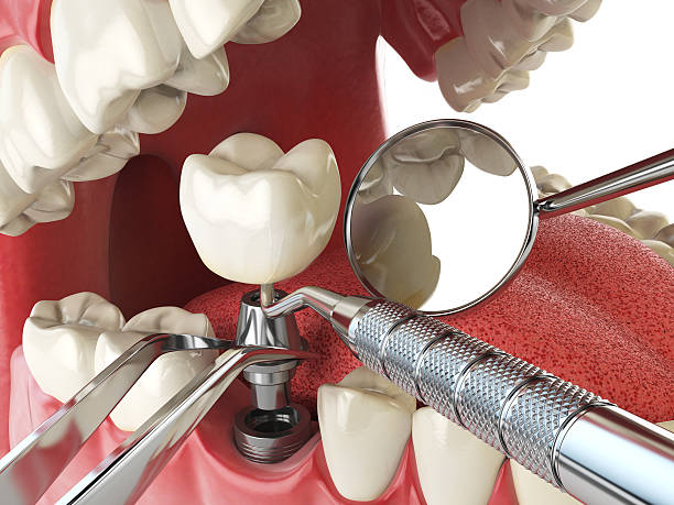 Best Emergency Treatment for Toothache in Wamego, KS